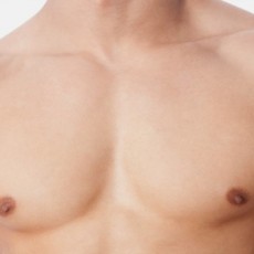 Male Breast Reduction Surgery in Canada
